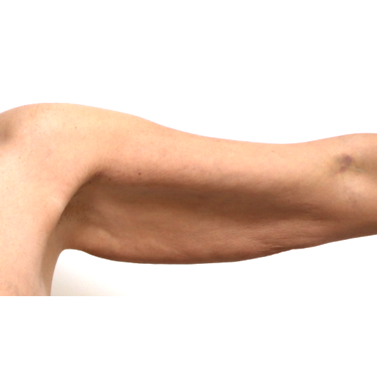 Before arm lift left arm