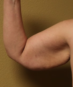 Before arm lift right arm